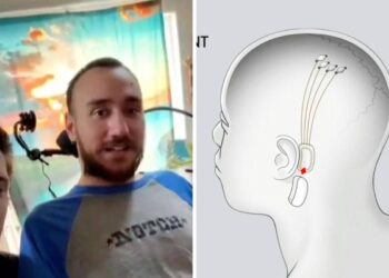 Forget Typing, We’ll Be Thinking Our Way Through Computers with Elon Musk’s Neuralink