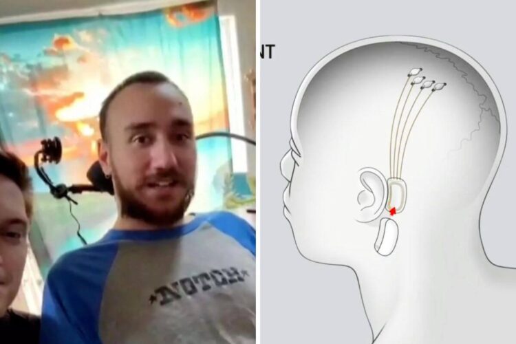 Forget Typing, We’ll Be Thinking Our Way Through Computers with Elon Musk’s Neuralink