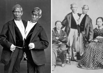Born Conjoined, They Built an Empire: The Extraordinary Lives of the Original Siamese Twins