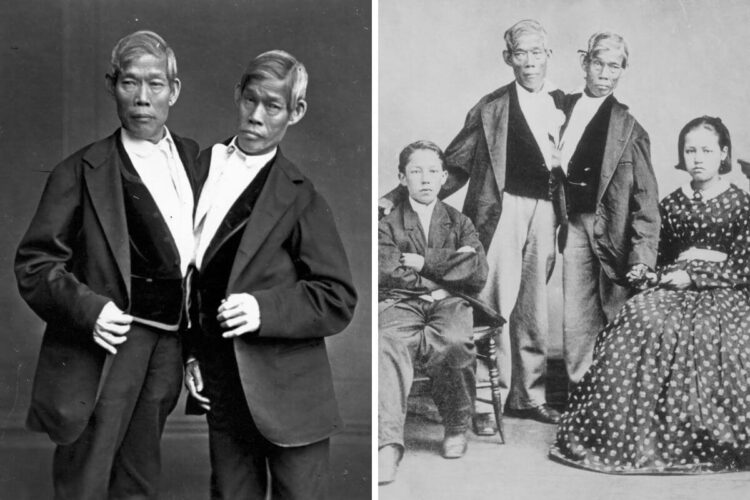 Born Conjoined, They Built an Empire: The Extraordinary Lives of the Original Siamese Twins